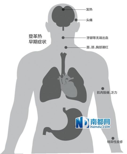 广州两名高龄登革热患者死亡 均患多种基础病
